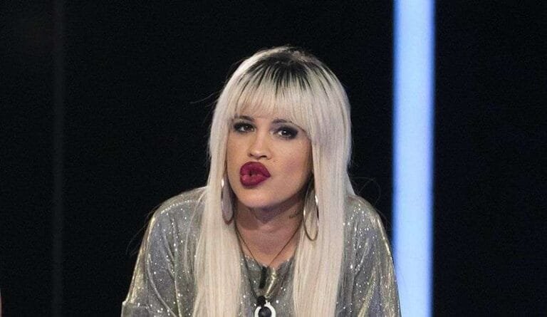 ‘GH DÚO’: Ylenia confiesa todos los retoques estéticos que se ha hecho