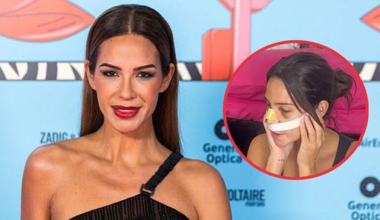 La transformación de Tamara Gorro: Descubre su renovada nariz tras someterse a una rinoplastia